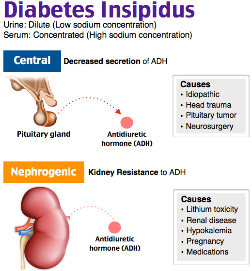 Diabetes insipidus – find out about symptoms, diagnosis, and more